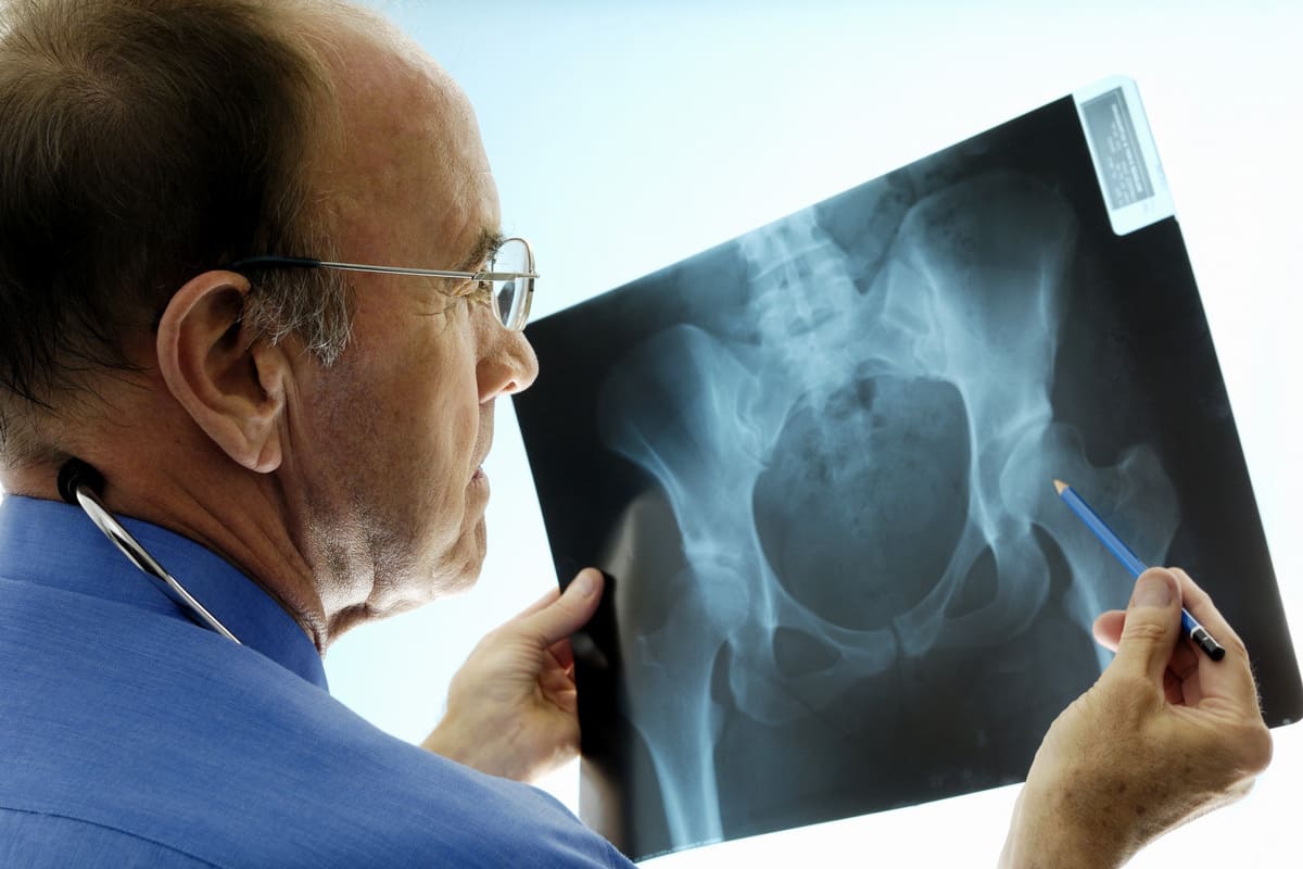 Learn What A Professional Has To Say On The Orthopaedics Doctor Near Me